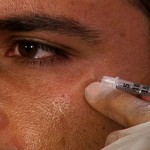 Restylane Dermal Filler Injection Technique